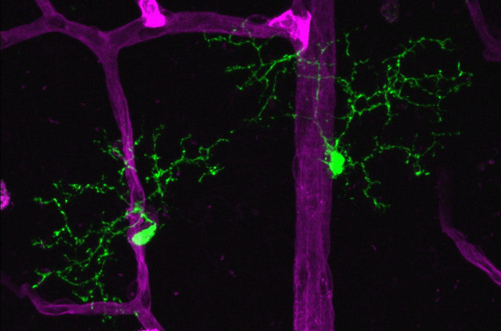 Microglial Activation in Children: What Researchers Are Learning